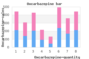 150 mg oxcarbazepine with mastercard